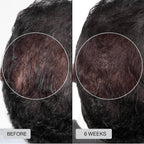 【🔥2026 New Products】Red Light Therapy Cap for Hair Regrowth Treatments